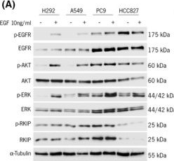 Fig.2.A showing Western Blotting from the publication: RKIP overexpression reduces lung adenocarcinoma aggressiveness and sensitizes cells to EGFR-targeted therapies.