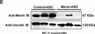 Fig.4.E showing Western Blotting from the publication: Menin inhibition suppresses castration-resistant prostate cancer and enhances chemosensitivity.