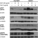 Fig.7.A showing Western Blotting in a Homo sapiens (Human) sample from the publication: Evaluation of epidermal growth factor receptor signaling effects in gastric cancer cell lines by detailed motility-focused phenotypic characterization linked with molecular analysis.