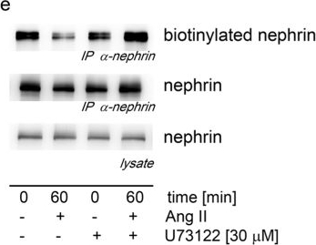 Angiotensin II increases glomerular permeability by β-arrestin mediated nephrin endocytosis.