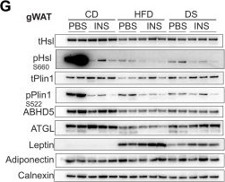 Fig.5.G showing Western Blotting from the publication: Integrated analysis of insulin resistance reveals metabolic remodeling following diet switch-triggered calorie reduction.