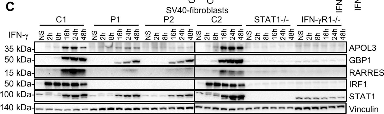 Fig.5.C showing Western Blotting from the publication: Human IRF1 governs macrophagic IFN-γ immunity to mycobacteria.