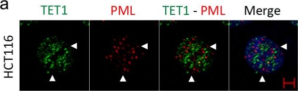 Fig.2.A showing Immunocytochemistry-immunofluorescence in a Homo sapiens (Human) sample from the publication: Vitamin C enhances co-localization of novel TET1 nuclear bodies with both Cajal and PML bodies in colorectal cancer cells.