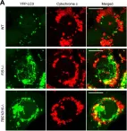 Fig.3.A showing Immunocytochemistry-immunofluorescence from the publication: Mitochondrial Rab GAPs govern autophagosome biogenesis during mitophagy.
