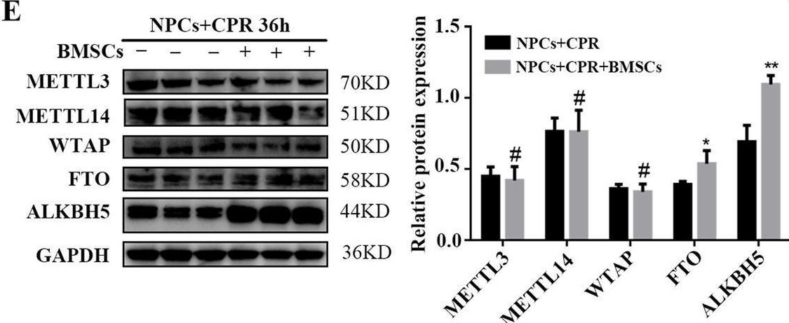 Fig.3.E showing Western Blotting from the publication: Bone-derived mesenchymal stem cells alleviate compression-induced apoptosis of nucleus pulposus cells by N6 methyladenosine of autophagy.
