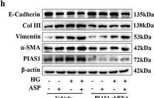 Fig.8.H showing Western Blotting from the publication: Asprosin Aggravates Tubular Epithelial Cell Injury and Phenotypic Transformation via Mitochondrial Dynamics Disorder Mediated by Excessive Drp1 SUMOylation in Diabetic Nephropathy Mice.
