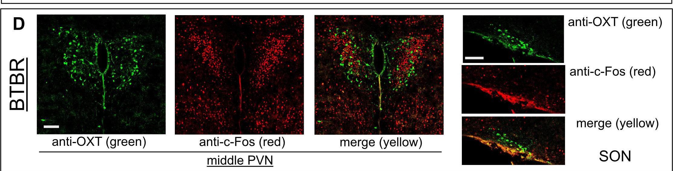 Fig.3.D showing Immunohistochemistry-immunofluorescence from the publication: Functional disruption of oxytocin projections participates atypical social and anxiety-like behaviours in BTBR mouse model of autism.