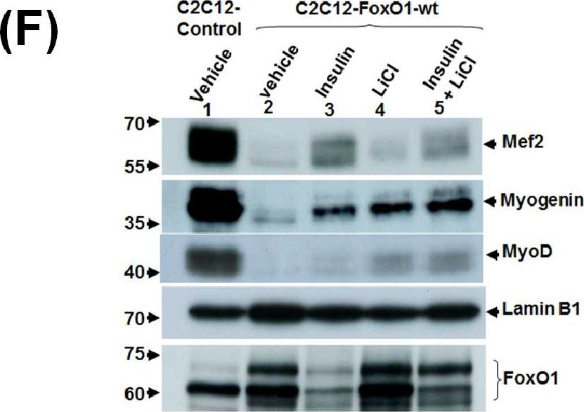 Fig.3.F showing Western Blotting from the publication: Insulin and LiCl synergistically rescue myogenic differentiation of FoxO1 over-expressed myoblasts.