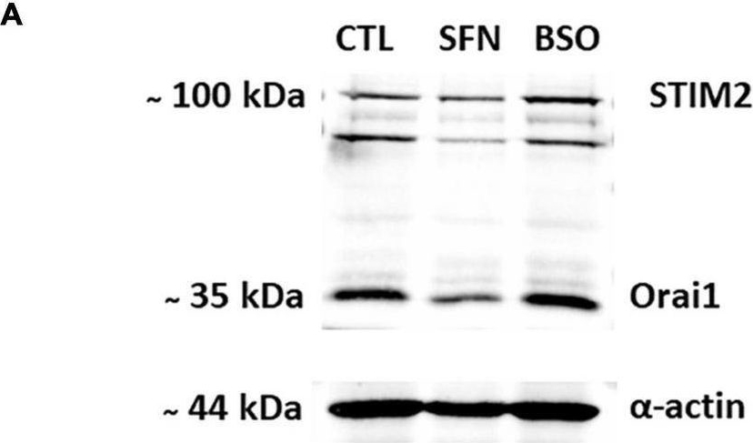 Fig.6.A showing Western Blotting in a Rattus norvegicus (Rat) sample from the publication: Manipulations of Glutathione Metabolism Modulate IP3-Mediated Store-Operated Ca2+ Entry on Astroglioma Cell Line.