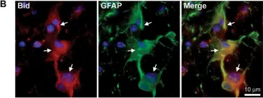 Fig.2.B showing Immunohistochemistry in a Mus musculus (House mouse) sample from the publication: The Bcl-2 Homology-3 Domain (BH3)-Only Proteins, Bid, DP5/Hrk, and BNip3L, Are Upregulated in Reactive Astrocytes of End-Stage Mutant SOD1 Mouse Spinal Cord.