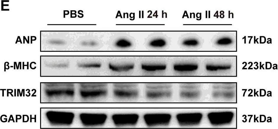 Fig.1.E showing Western Blotting in a Mus musculus (House mouse) sample from the publication: Tripartite motif 32 prevents pathological cardiac hypertrophy.