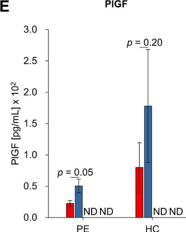 Fig.3.E showing Enzyme-linked immunosorbent assay from the publication: Understanding the role of soluble proteins and exosomes in non-invasive urine-based diagnosis of preeclampsia.