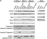 Fig.5.A showing Western Blotting from the publication: Combined treatment with inhibitors of ErbB Receptors and Hh signaling pathways is more effective than single treatment in reducing the growth of malignant mesothelioma both in vitro and in vivo.