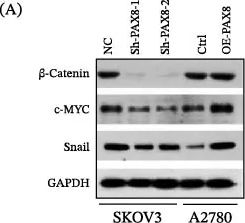 Fig.3.A showing Western Blotting in a Homo sapiens (Human) sample from the publication: Adipose-Derived Mesenchymal Stem Cells Reduce miR-214-5p to Promote Ovarian Cancer Progression via the β-Catenin Pathway by Targeting PAX8.