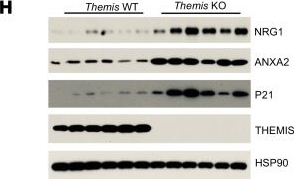 Fig.3.H showing Western Blotting in a Mus musculus (House mouse) sample from the publication: THEMIS attenuates MASH by suppressing disease-associated hepatocyte induction and hepatocyte senescence in mice.