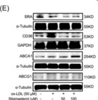Fig.4.E showing Western Blotting from the publication: Stigmasterol attenuates atherosclerosis by inhibiting inflammatory signaling and foam cell formation.