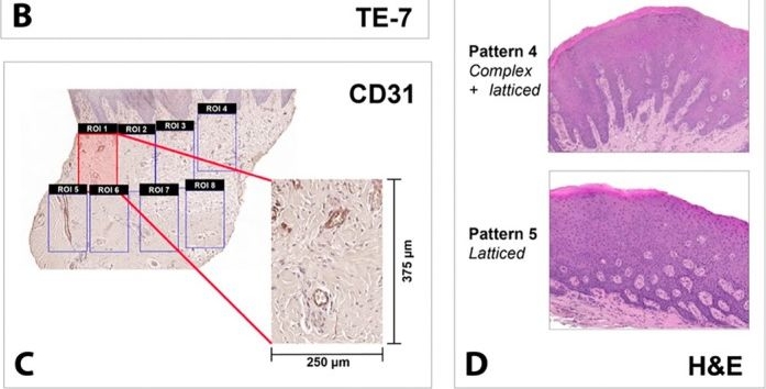 Fig.2.B showing Immunohistochemistry from the publication: Immunohistological Evaluation of Peri-Implant Soft Tissue Grafting Using a Porcine Dermal Matrix-A Human Histological Study.
