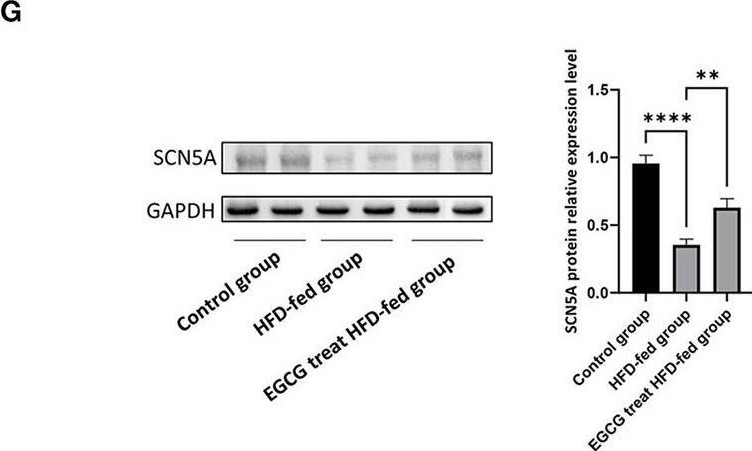 Fig.3.G showing Western Blotting from the publication: EGCG Alleviates Obesity-Induced Myocardial Fibrosis in Rats by Enhancing Expression of SCN5A.