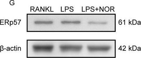 Fig.8.G showing Western Blotting in a Homo sapiens (Human) sample from the publication: Norwogonin Attenuates Inflammatory Osteolysis and Collagen-Induced Arthritis via Modulating Redox Signalling and Calcium Oscillations.