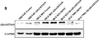 Fig.2.B showing Western Blotting from the publication: ADAMTS19 Suppresses Cell Migration and Invasion by Targeting S100A16 via the NF-κB Pathway in Human Gastric Cancer.