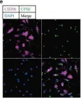 Fig.6.E showing Immunocytochemistry-immunofluorescence from the publication: Sequence Variation of Candida albicans Sap2 Enhances Fungal Pathogenicity via Complement Evasion and Macrophage M2-Like Phenotype Induction.