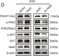 Fig.5.D showing Western Blotting from the publication: Transcription cofactor Hes6 interacts with Twist1 to facilitate EMT and promote gastric carcinogenesis by activating the PI3K/AKT signaling.