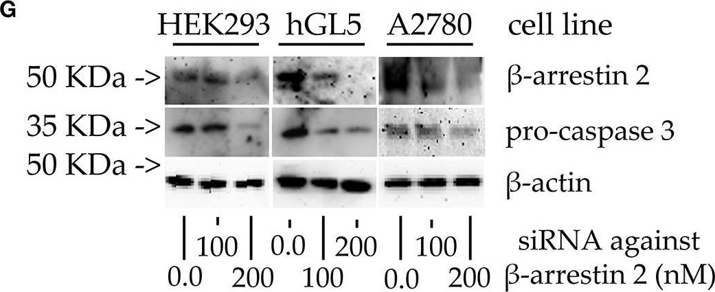 Fig.5.G showing Western Blotting in a Homo sapiens (Human) sample from the publication: β-arrestin 2 Is a Prognostic Factor for Survival of Ovarian Cancer Patients Upregulating Cell Proliferation.