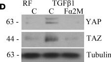 Fig.4.D showing Western Blotting from the publication: Inhibition of cell surface GRP78 and activated α2M interaction attenuates kidney fibrosis.