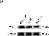 Fig.4.D showing Western Blotting in a Homo sapiens (Human) sample from the publication: WTAP-mediated m6A methylation of SOX2 affects lung adenocarcinoma malignancy via Wnt/β-catenin pathway.