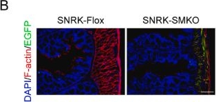 Fig.2.B showing Immunohistochemistry-immunofluorescence from the publication: Smooth muscle cell (SMC)-Specific SNRK deletion in mouse causes congenital short bowel syndrome and premature death.