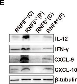Fig.2.E showing Western Blotting in an Armoracia rusticana (Horseradish) sample from the publication: RNF8 enhances the sensitivity of PD-L1 inhibitor against melanoma through ubiquitination of galectin-3 in stroma.