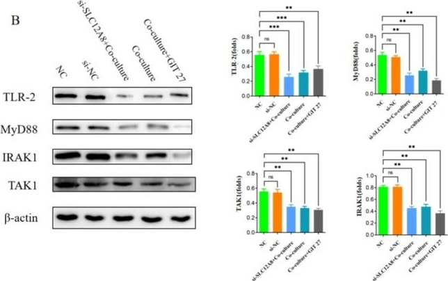 Fig.8.B showing Western Blotting in a Homo sapiens (Human) sample from the publication: SLC12A8 Drives Immune Evasion and Metastasis in Luminal B Breast Cancer by Inducing CD8+ T-Cell Exhaustion via the TLR Signaling Pathway.