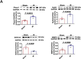Fig.8.A showing Flow cytometry/Cell sorting in a Rattus norvegicus (Rat) sample from the publication: Spatial Transcriptional Heterogeneity in the Infarct Core and Its Surrounding Regions Targeting Piezo1 Signals in Rats With Myocardial Ischemia-Reperfusion Injury.