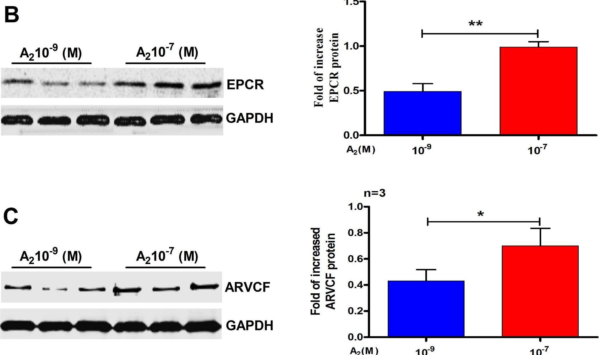 Fig.4.B showing Western Blotting from the publication: Androgen-induced alterations in endometrial proteins crucial in recurrent miscarriages.