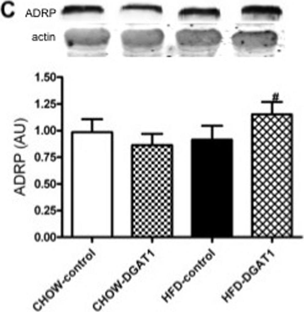 Paradoxical increase in TAG and DAG content parallel the insulin sensitizing effect of unilateral DGAT1 overexpression in rat skeletal muscle.