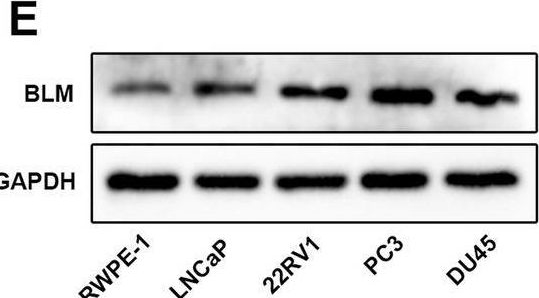 Fig.1.E showing Western Blotting from the publication: PARP1 negatively regulates transcription of BLM through its interaction with HSP90AB1 in prostate cancer.
