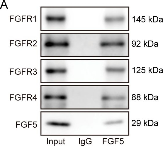 Fig.5.A showing Western Blotting from the publication: Cancer-associated fibroblasts secrete FGF5 to inhibit ferroptosis to decrease cisplatin sensitivity in nasopharyngeal carcinoma through binding to FGFR2.