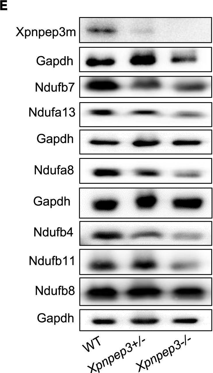 Fig.6.E showing Western Blotting from the publication: Mutational burden of XPNPEP3 leads to defects in mitochondrial complex I and cilia in NPHPL1.