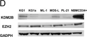 Fig.1.D showing Western Blotting in a Homo sapiens (Human) sample from the publication: The KDM2B- let-7b -EZH2 axis in myelodysplastic syndromes as a target for combined epigenetic therapy.