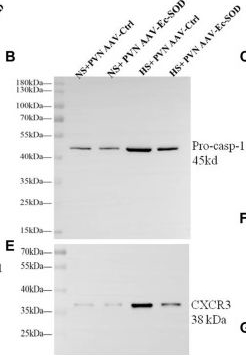 Fig.5.B showing Western Blotting from the publication: Bilateral Paraventricular Nucleus Upregulation of Extracellular Superoxide Dismutase Decreases Blood Pressure by Regulation of the NLRP3 and Neurotransmitters in Salt-Induced Hypertensive Rats.