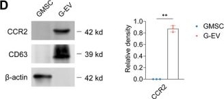 Fig.5.D showing Western Blotting from the publication: CCR2 Orchestrates Preferential Homing and Therapeutic Efficacy of Gingival Mesenchymal Stem Cell-Derived Extracellular Vesicles in Rheumatoid Arthritis.