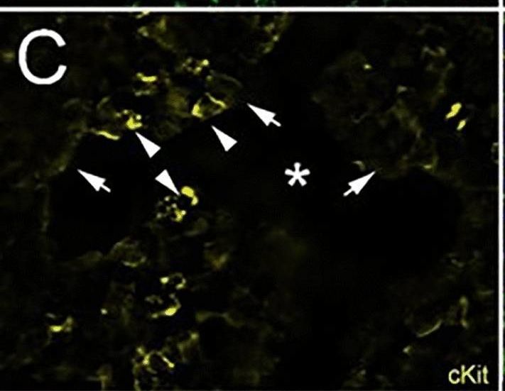 Fig.5.C showing Immunohistochemistry-immunofluorescence from the publication: Bone marrow stromal cell-derived hepcidin has antimicrobial and immunomodulatory activities.
