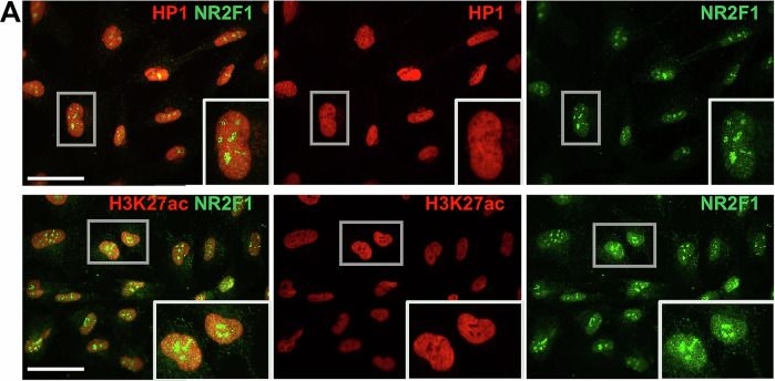 Fig.1.A showing Immunocytochemistry-immunofluorescence in a Mus musculus (House mouse) sample from the publication: Unravelling the conundrum of nucleolar NR2F1 localization using antibody-based approaches in vitro and in vivo.