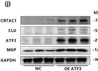 Fig.5.I showing Western Blotting in a Homo sapiens (Human) sample from the publication: Single-cell RNA sequencing reveals the CRTAC1+ population actively contributes to the pathogenesis of spinal ligament degeneration by SPP1+ macrophage.
