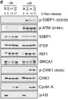 Fig.2.D showing Western Blotting from the publication: Cell cycle-dependent inhibition of 53BP1 signaling by BRCA1.