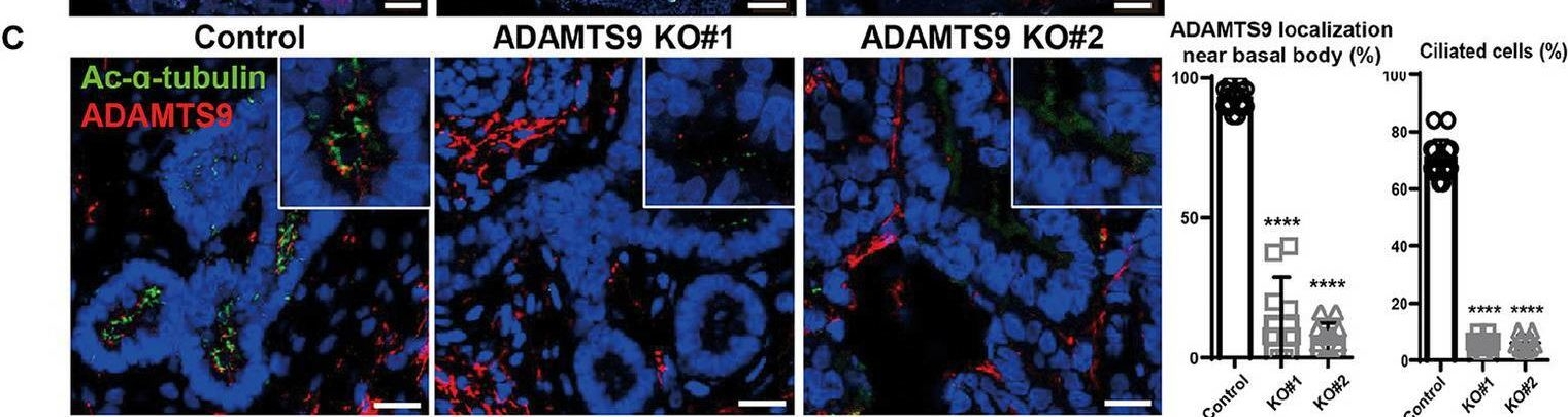 Fig.2.C showing Immunohistochemistry-immunofluorescence in a Homo sapiens (Human) sample from the publication: Disease modeling of ADAMTS9-related nephropathy using kidney organoids reveals its roles in tubular cells and podocytes.