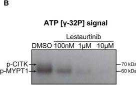 Fig.1.B showing Western Blotting from the publication: Lestaurtinib inhibits Citron kinase activity and medulloblastoma growth through induction of DNA damage, apoptosis and cytokinesis failure.