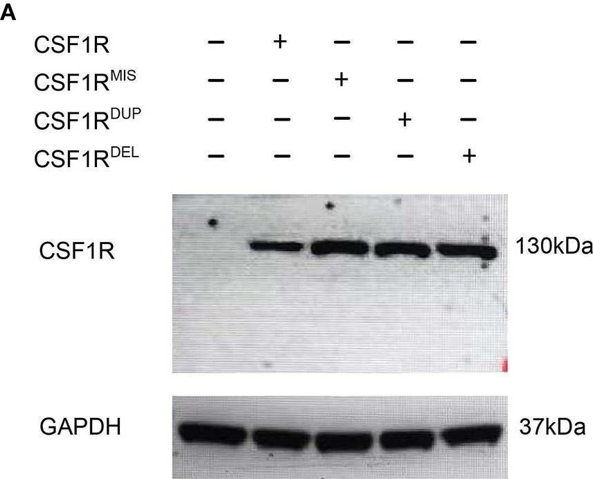 Fig.3.A showing Western Blotting in a Danio rerio (Zebrafish) sample from the publication: Variants Affecting the C-Terminal of CSF1R Cause Congenital Vertebral Malformation Through a Gain-of-Function Mechanism.