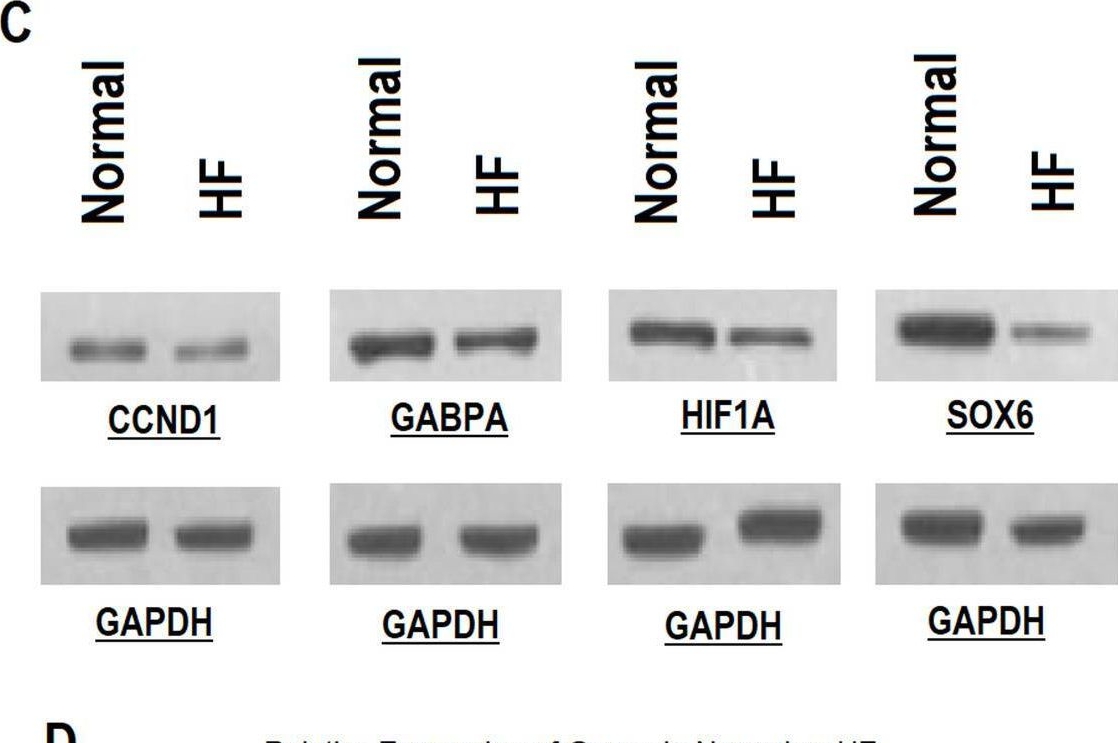 Fig.4.C showing Western Blotting in a Homo sapiens (Human) sample from the publication: Multi-omics approach reveals CCND1, GABPA, HIF1A, and SOX6 as key regulators and prognostic markers in heart failure.