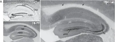 Fig.3.A showing Immunohistochemistry from the publication: Differential spatial expression and subcellular localization of CtBP family members in rodent brain.